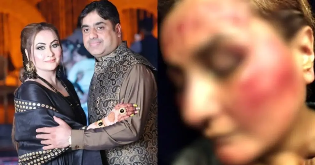 1000086864 1200x628 1024x536 1